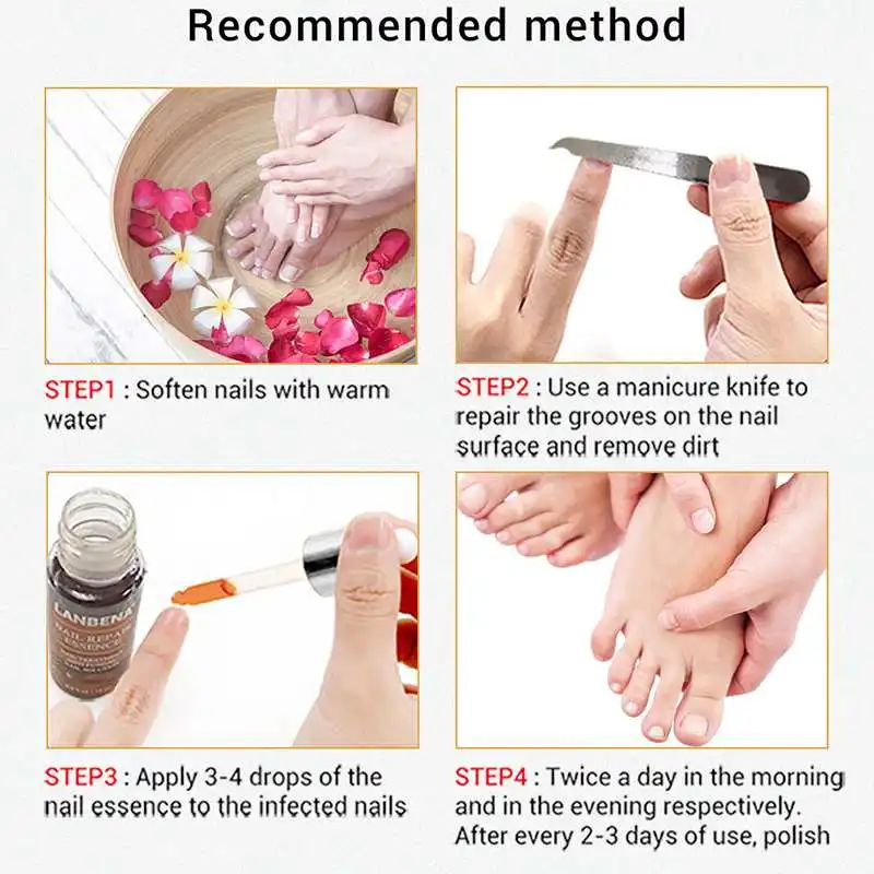 Новый 12 мл Лечение грибка ногтей с напильником анти Грибное удаление онихомикоза