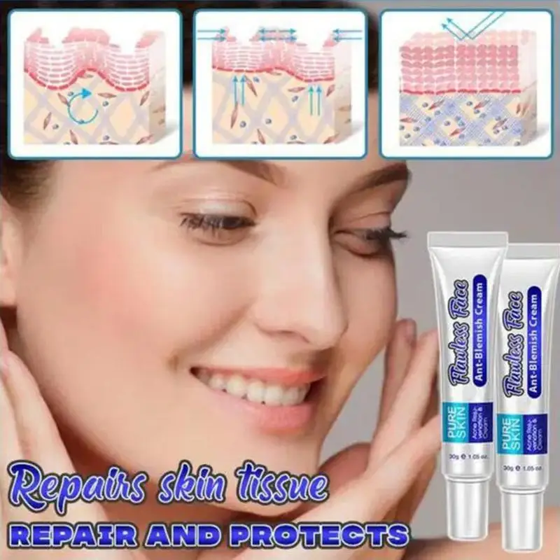 Natural Herbal Topical Cream Face Pimples Scar Stretch Marks Removal Acne Cream Whiten Face Skin Care Treatment