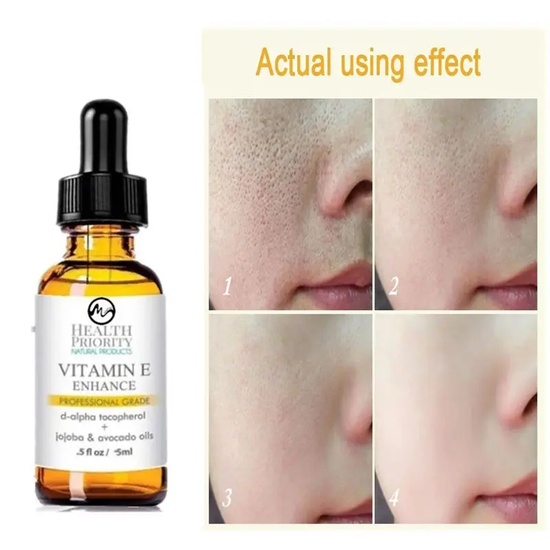 Minch витамина Е от шрамов уход за кожей лица Сыворотки уменьшение морщин