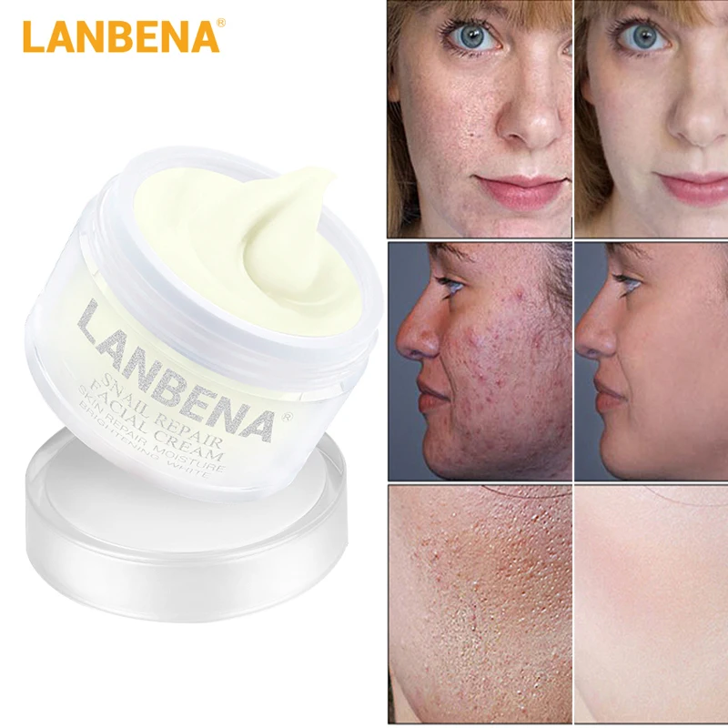 LANBENA с экстрактом улитки восстановление и отбеливание крем для лица покрытыем