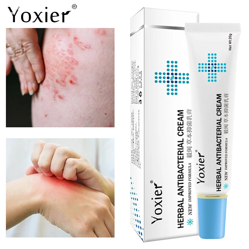 

Травяной Антибактериальный дневной крем, дневная экзема, уртикария, дерматит, безопасное нежное лечение кожи 20 г