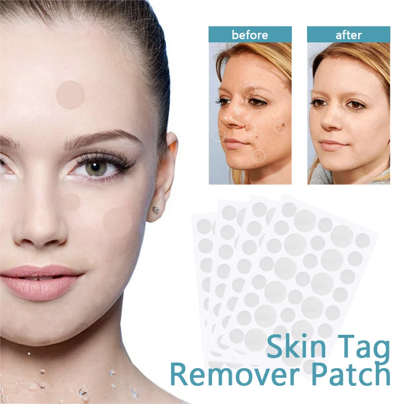 

36pcs Skin Tag Remover Warts Remover Patch Wart Treatment Cream Herbal Extract Foot Corn Plaster Acne Warts Ointment