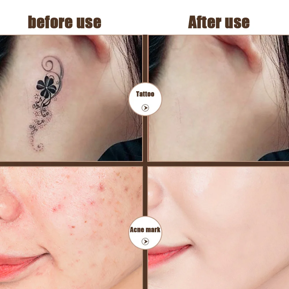 2 шт Универсальный водостойкий консилер увлажняющий чехол для пятен Шрам Пятна