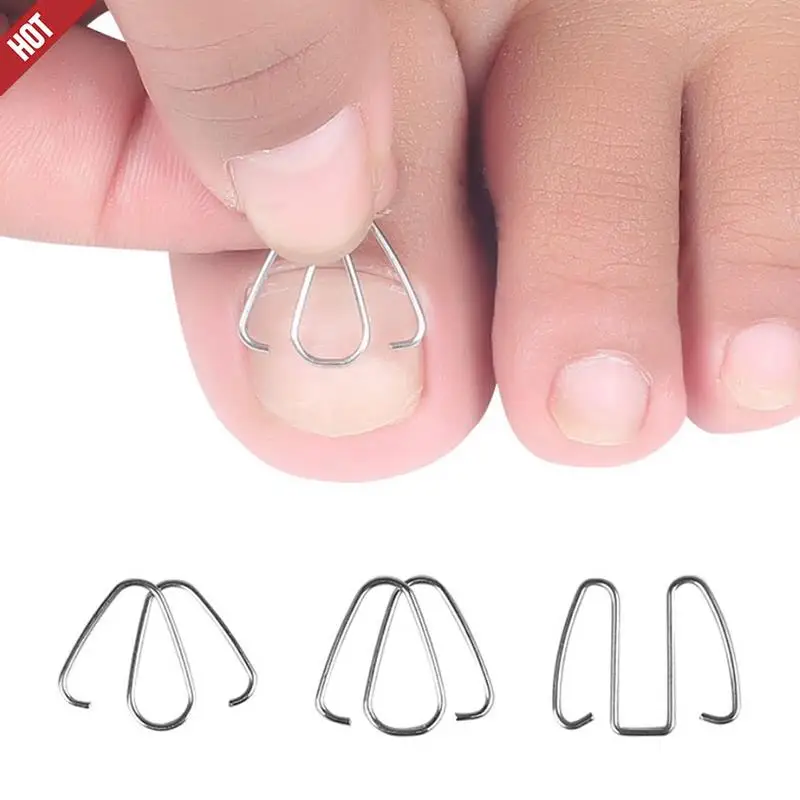 3 пары передний крючок для ногтей/резиновая лента нейл-арта коррекция вросших