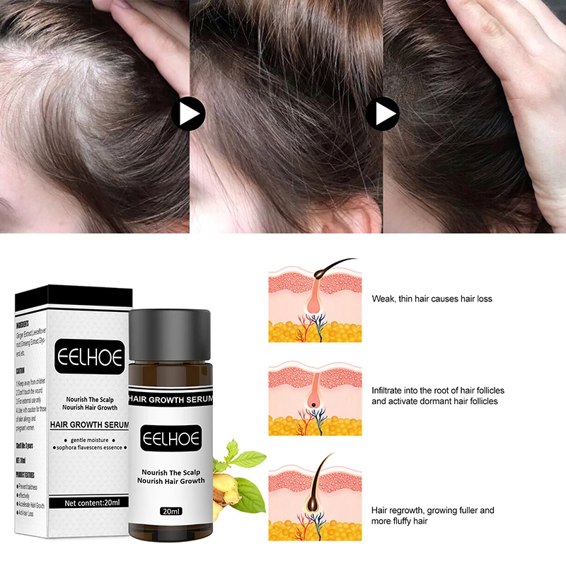 Hair Care Hair Growth Essential Oils Essence Original Authentic Hair Loss Liquid Health Care Beauty 