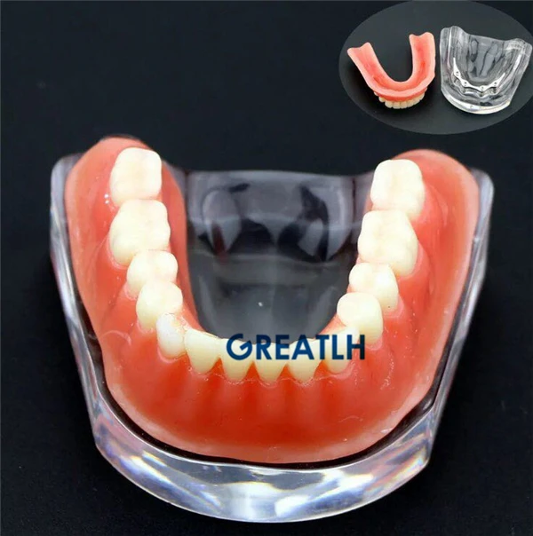 Overdenture implant model Denture Teeth mandibular with golden bar Dental Teaching Model | Красота и здоровье