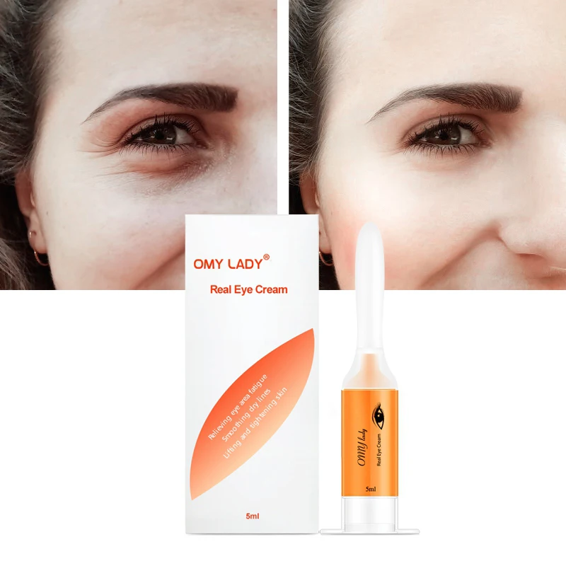 OMY LADY EyeCream мгновенное удаление глаз мешки укрепляющие глаза против отечности