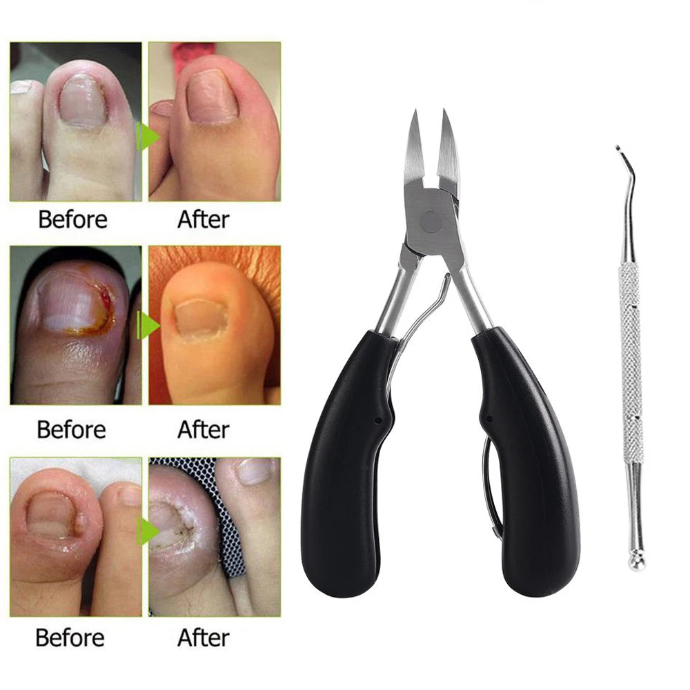 Набор кусачек для ногтей вросших педикюра и кусачки кутикулы инструменты ухода
