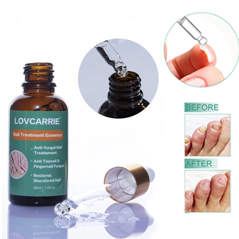 Жидкость для удаления кутикулы ногтей 2 шт./компл. 30 мл|Средства ухода за ногтями| |