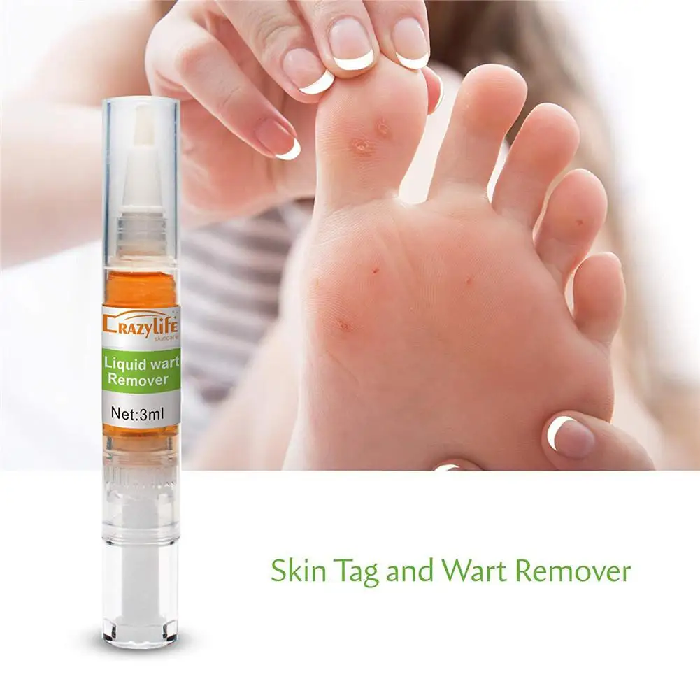 

2 Pcs Foot Wart Treatment Foot Wart Remover Painless Skin Tag Mole Remover Anti Verruca Remedy Warts Liquid