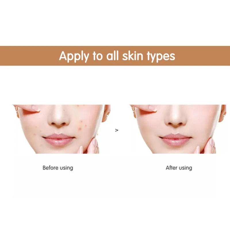 

Long-lasting Essence Fade Out Skin Fine Lines Serums Nourishing Salicylic Acid Essence Blind Shipping