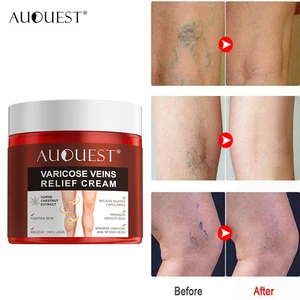 AUQUEST Varicose Veins Treatment Cream Relieve Tired Legs Dilated Vasculitis Phlebitis Spider Pain R in USA (United States)