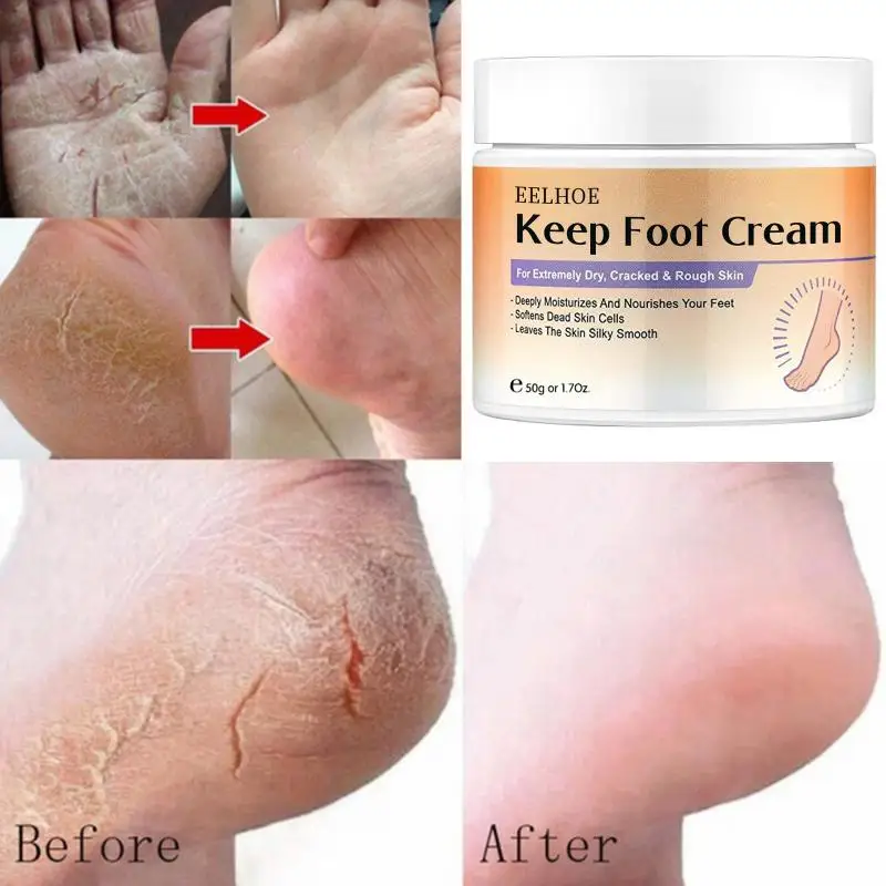 

Winter Anti-Cracked Foot Cream Feet Natural Herbal Anti-crack Anti Aging Moisturizing Exfoliate Anti Wrinkle Foot Cream TSLM1