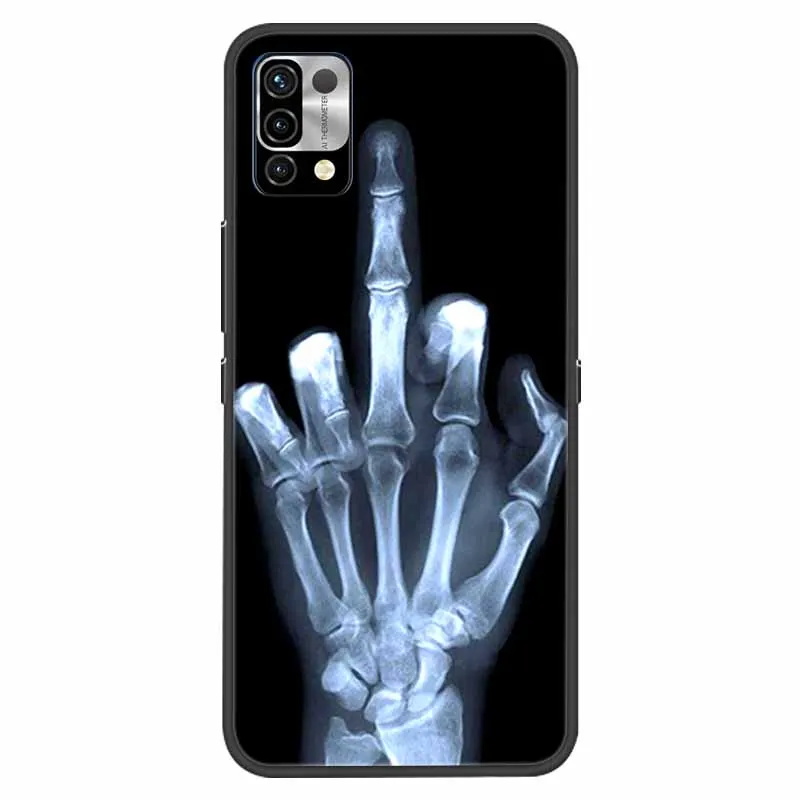 For Umidigi Power 5 Power5 Case Shockproof Soft silicone TPU Back Cover For Umidigi Power 5S Phone Cases Power 5 S Cute Cartoon