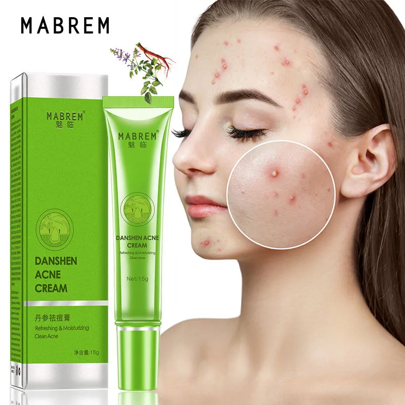 

Effective Acne Removal Cream Scar Treatment Fade Spots Oil Control Shrink Pores Whitening Moisturizing Facial Skin Care