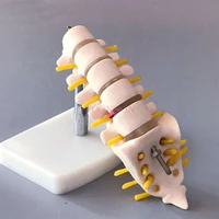 spine model small lumbar spine tail vertebra bone model anatomy bone nerve structure model teaching medical teaching aids
