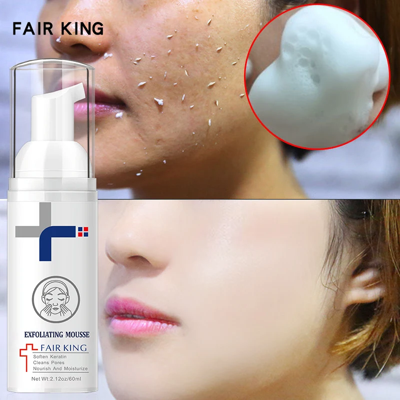 

Facial Exfoliating Mousse Peeling Gel Face Scrub Deep Remove Cleaning Pore Cleanser Smooth Moisturizing Skin Exfoliator Cream