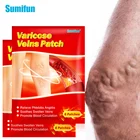 Пластырь от варикозного расширения вен Sumifun, 612 шт.