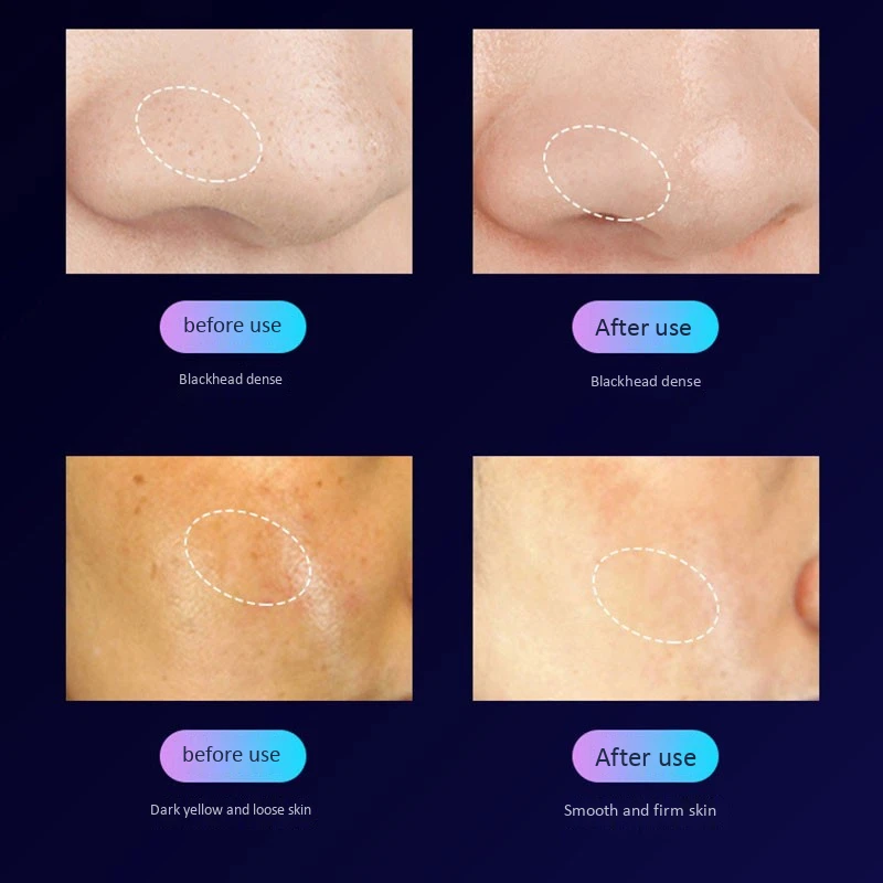 

Rechargeable Face Skin Scrubber Facial Cleaner Peeling Vibration Blackhead Removal Exfoliating Pore Cleaner Tools