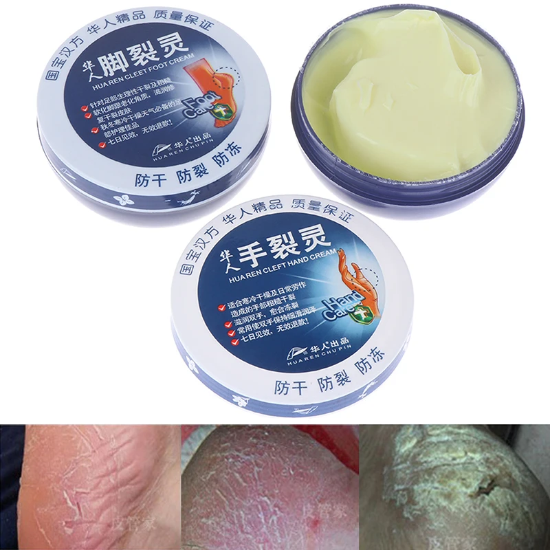 Восстанавливающий крем для ног и рук удаление омертвевшей кожи традиционное