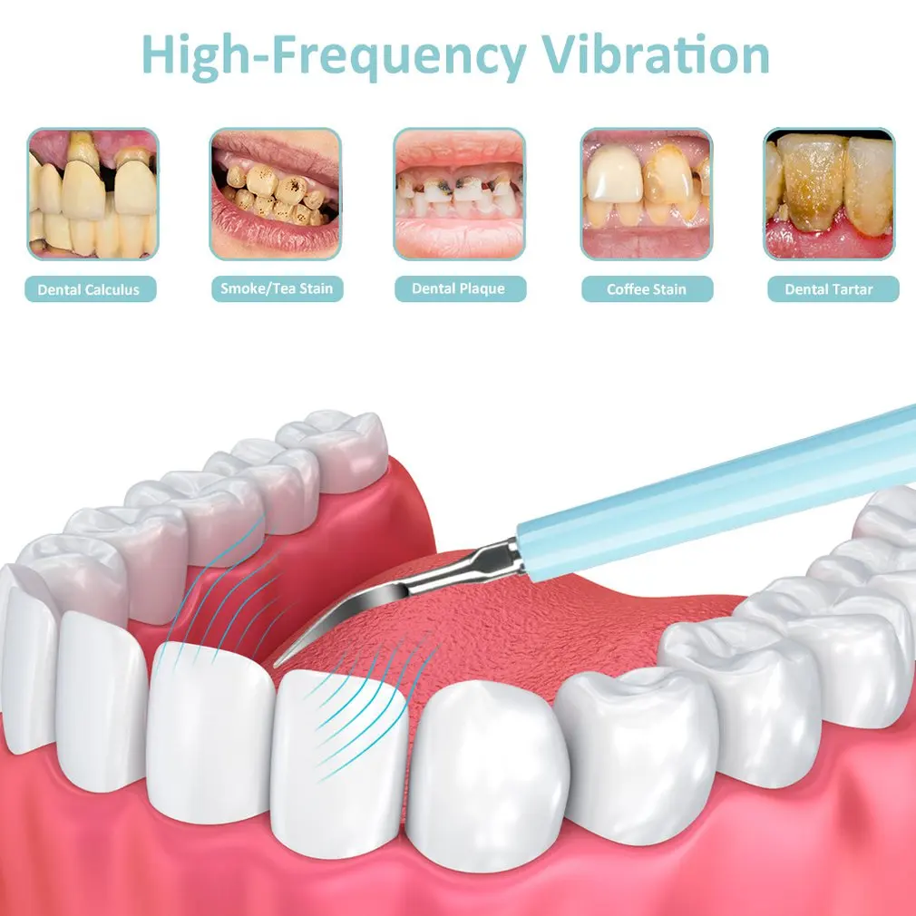 

2 In 1 High Frequency Electric Brushing And Washing Scaler Ultra Sonic Teeth Calculator Remover Whitening Tool