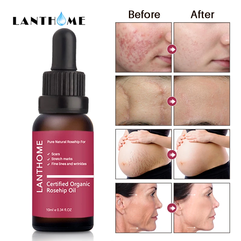 

Органическое увлажняющее эфирное масло для лица, 10 мл