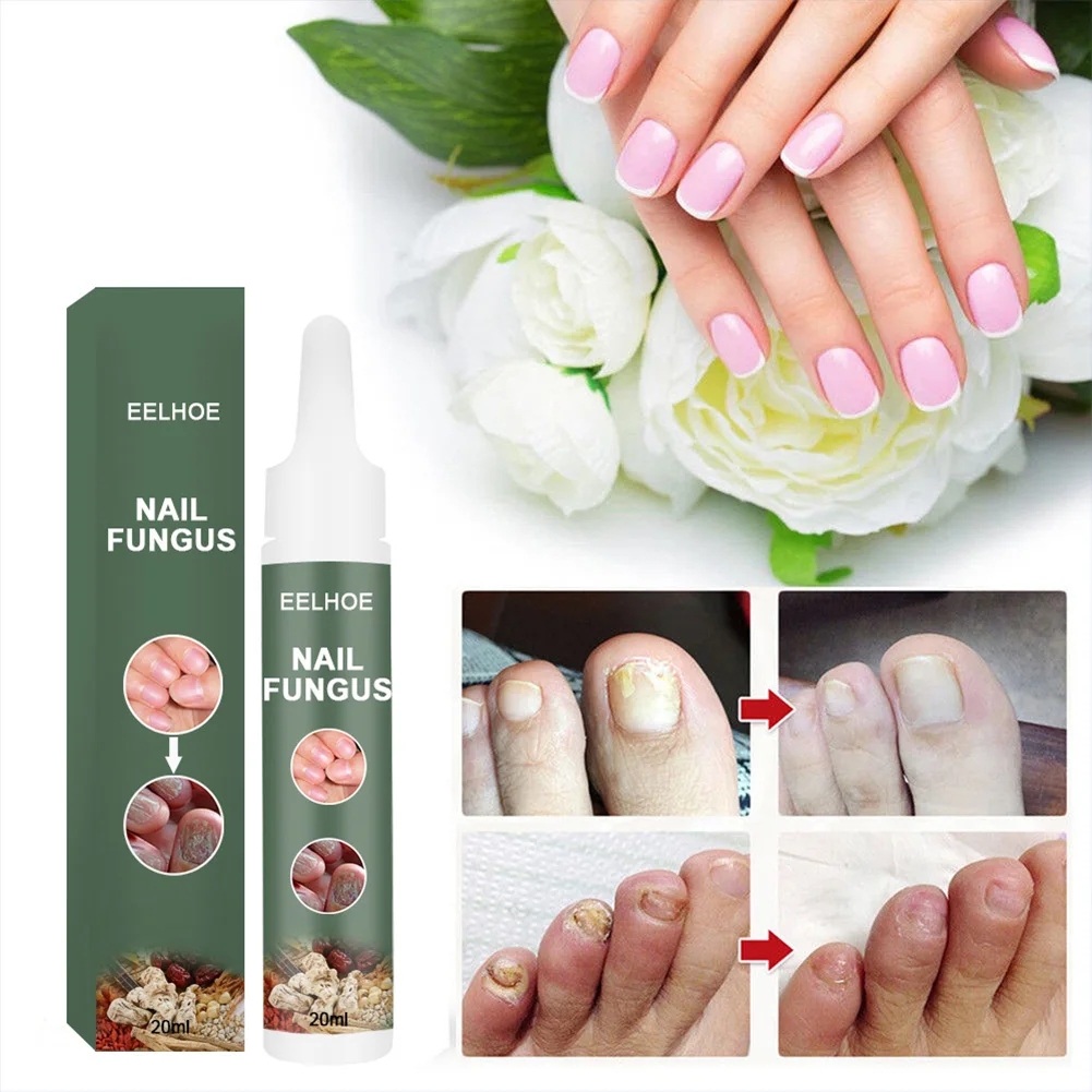 

20/15ml Nail Repair Fungus Treatment Anti-Fungal Solution Promote New Growth of Nails for Fingernails Toenails Fast delivery