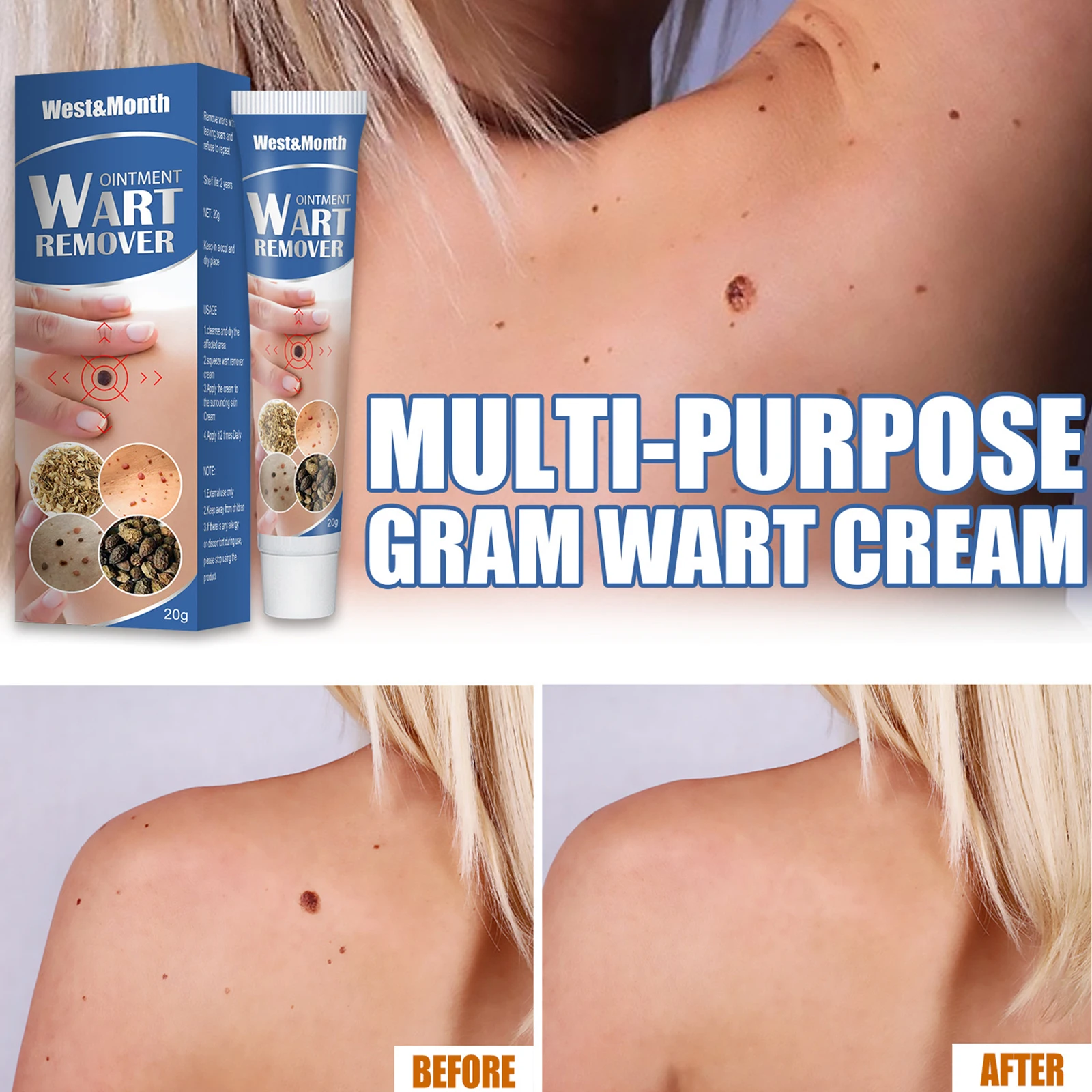 

Instant Blemish Removal Gel Whitening Anti Warts Cream Effectively Remove the Warts Pigmented Melanin Spots Skin Care 20g