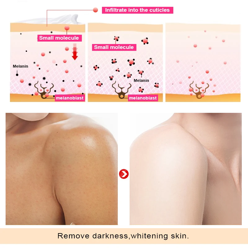 OMY LADY отбеливающий крем для тела быстрого отбеливания кожи увлажняющий удаления