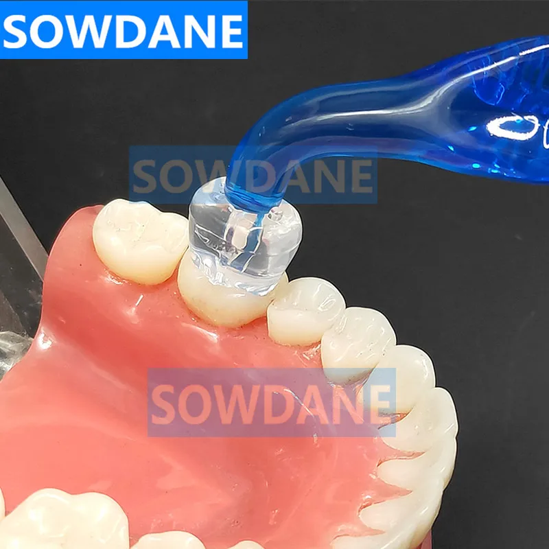 Набор для реставрации зубов ental инструмент коррекции и наполнения композитный