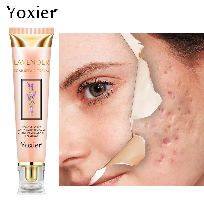 

Yoxier Lavender Scar Repair Cream Acne Scar Stretch Marks Pigmentation Corrector Anti-allergic Calm Whitening Skin Care 20g