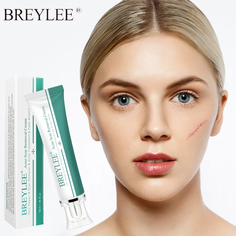 BREYLEE шрам для удаления рубцов от акне восстанавливающий гель крем лица Лечение