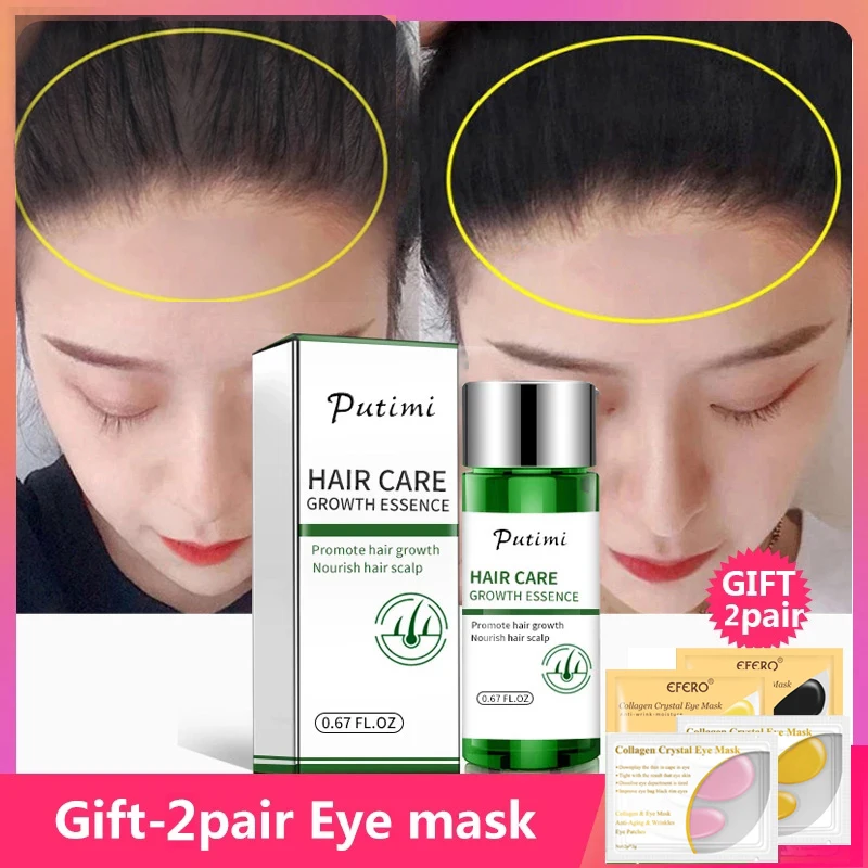 

Эссенция Putimi для роста волос натуральный Имбирь против выпадения эффективная густая Сыворотка для роста волос 20 мл предотвращает облысени...