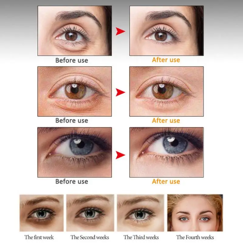 Пептидный коллагеновый крем для глаз роликовый массажер патчи омолаживающее