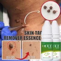 10ml skin tags remove liquid treatment foot corn papillomas mole plantar warts removal neck armpit skin tag health care tool
