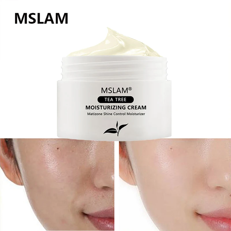 

Organic Tea Tree Herbal Acne Removal Cream Anti-inflammation Skin Care Pore Cleaner Pimple Spot Remover Acne Treatment Cream