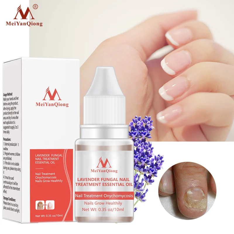 

Fungal Nail Treatment Feet Care Essence Removal Fungus Healthy Repair Serum Anti Infection Paronychia Onychomycosis
