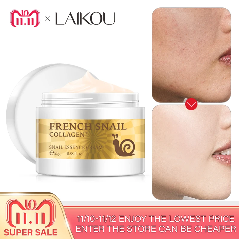 Лицо улитки крем с гиалуроновой кислотой против морщин анти-старения для лица