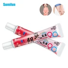 Крем от экземы, бактериостаза, экзематоидный крем для внутренней части бедра, экземы, дерматита, 13 шт.