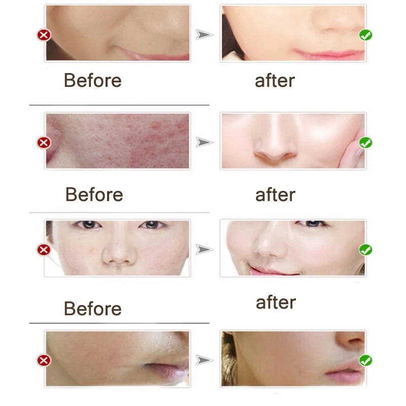 Увлажняющий коллагеновый крем для лица с витамином Е против морщин отбеливающий