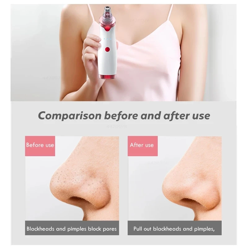 

Blackhead Remover Face Deep Nose Cleaner T Zone Pore Acne Pimple Removal Vacuum Suction Facial Diamond Beauty Clean Skin Tool