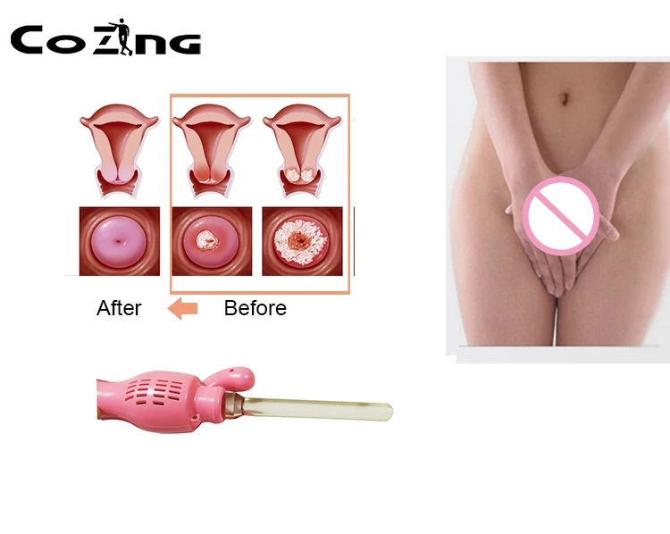 Red Light Therapy Personal Wand Massager Vibrator Device | Красота и здоровье