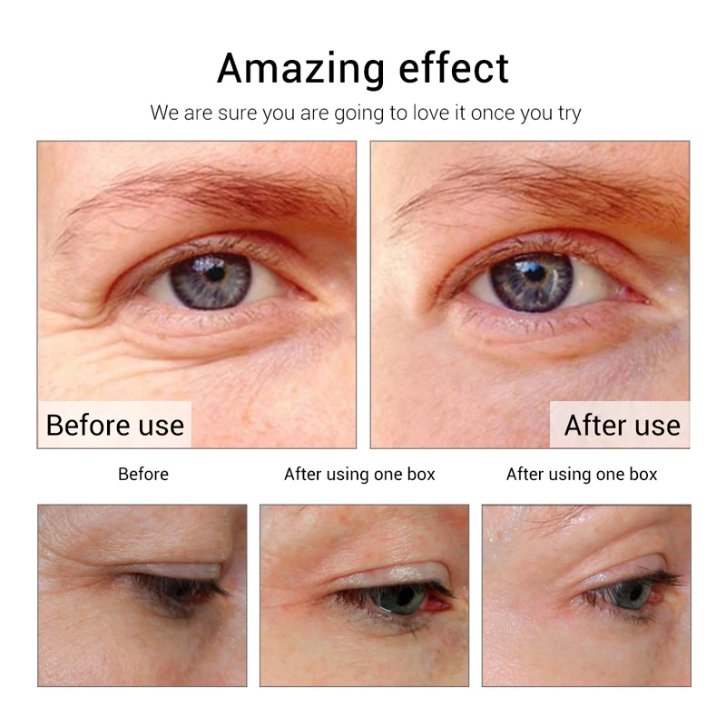 

30/20/10Pcs Collagen Gold Eye Mask Anti-Aging Anti Wrinkle Dark Circles Remove Moisturizing Eye Patches Beauty Eyes Skin Care