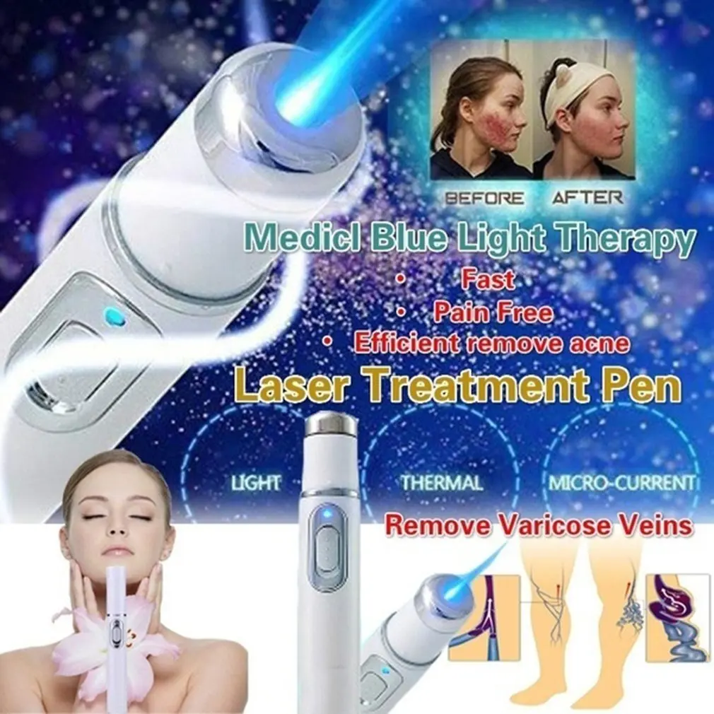 Acne Laser Pen Portable Wrinkle Removal Machine Durable Soft Scar Remover Blue Therapy Light Massage Spider Vein Eraser | Красота и