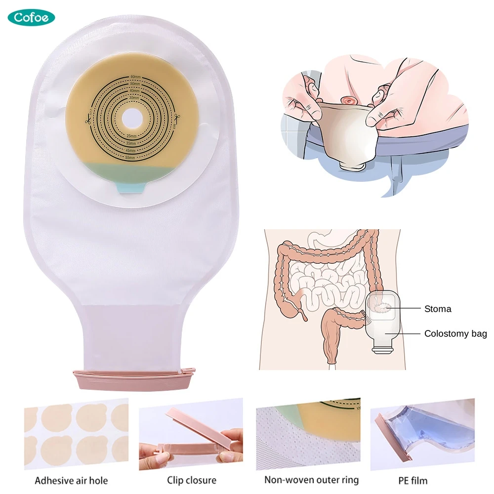 Cofoe 10 шт цельная система Ostomy сумка водостойкая Сумка-колостомия сумка Ostomy Stoma 60 мм Размер выреза бежевая крышка сумка для мочи