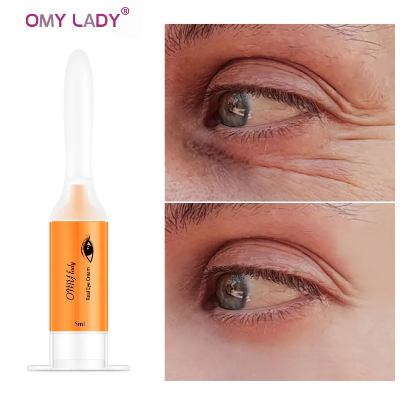 OMY LADY для ухода за областью вокруг глаз мгновенный средство удаления морщин анти