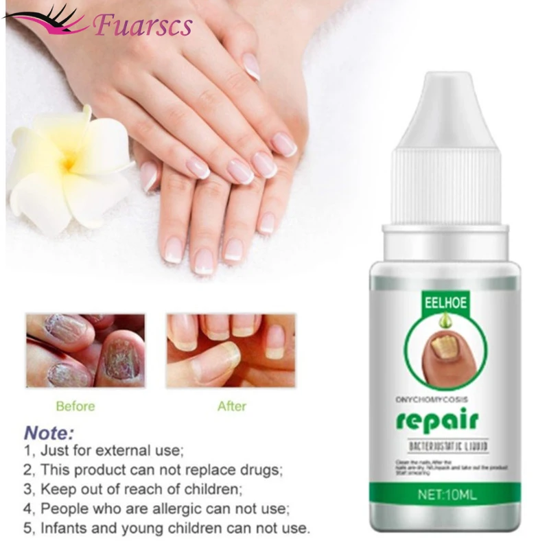 

Nail Fungus Treatment Essence Serum Foot Repair Toe Nail Fungus Removal Gel Anti Infection Paronychia Onychomycosis Feet Care