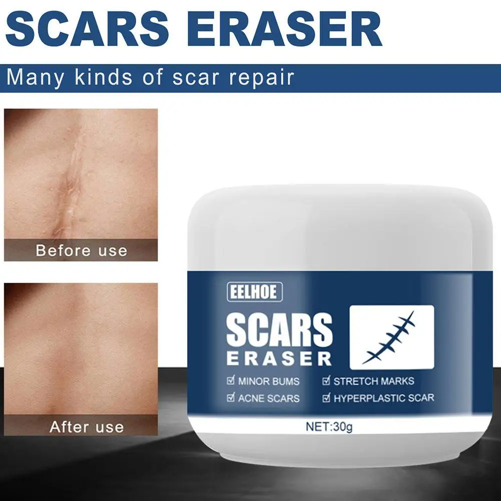 

30g Scar Cold Compress Gel Scar Removal Cream Acne Scars For Body Pigmentation Scar Gel Stretch Burn Corrector Surgical Mar G9V3