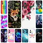 Чехол для Xiaomi Mi 10T 5G, мягкий чехол из ТПУ для Xiaomi Mi 10T Pro, задняя крышка для телефона Mi 10T Pro 5G Mi10T, силиконовый бампер