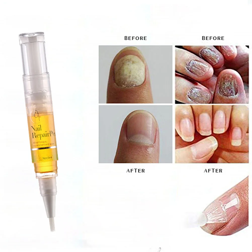 

5ml Nail Care Solution Nail Nutrient Solution Gel Nail Foot Care